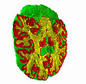 Interfaces between white matter, grey matter, and other matter for a human brain data set.<BR>
<BR>
It is difficult to determine the structure of complex data set like the human brain, but researchers from the University of California-Davis have developed a method to track the boundary surfaces (or interfaces) between multiple materials in complex data sets, and have applied this method to the human brain. They first produced a data set where each data item contained a probability that certain types of material exist in the region of the data point. Then, segmentation methods are applied to generate the boundary surfaces. The illustration shows the interfaces between white matter, grey matter, and other matter for a human brain data set. The boundaries have been clipped to illustrate the interior of the brain.<BR>
<BR>
This work was supported in part by a grant from the National Science Foundation's Large Scientific and Software Data Set Visualization program, grant ACI 99-82251.  Thumbnail