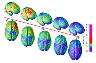 image of Time-Lapse Imaging Tracks Brain Maturation from ages 5 to 20