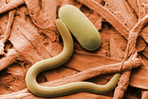 Photo: Low-temperature scanning electron micrograph of soybean cyst nematode and its egg. Link to 300-dpi version