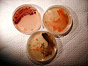 This photograph shows three species of bacteria from the genus <I>Salinospora</I> growing on agar culture plates. These bacteria, which had never been observed until 2001, are major microbial inhabitants in marine sediments from the deep oceans. It can be estimated that perhaps 10,000 species of these microbes will ultimately be harvested from the marine environment. This is important because testing these microbes for their affects against diseases and cancer has shown that they, like the bacteria in soil, produce antibiotics and anticancer agents. Because these are genetically and environmentally unique--and have never been seen or studied before, they represent an enormous resource for the discovery of new drugs. For example, one strain of these bacteria has been shown to produce a very powerful anticancer agent called salinosporamide A. Many of the drugs that have been in use for a long time have developed a resistance and are no longer as effective. We are in need of an entirely new group of antibiotics. The massive areas encompassed by the deep oceans represent a new biomedical resource of massive proportion.<BR>
<BR>
<U><B>More about this Image</B></U><BR>
This image was taken during research conducted by Dr. William Fenical and his team. Dr. Fenical is a Professor of Oceanography at Scripps Institution of Oceanography. His many research projects can require support from both the National Science Foundation (NSF) and the National Institutes of Health (NIH). NSF support is used for the environmental exploration side of his work and then for example, if a project turns from fundamental marine chemical ecology to biomedicine, the research then receives support from NIH (NSF does not support direct biomedical research).  Thumbnail