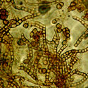 Microscopic photo of metal-oxidizing bacteria found in biofilm samples taken from a South African gold mine. Samples were taken as part of the University of Tennessee's (UT) Biogeochemical Educational Experiences - South Africa (BEE-SA)a Research Experiences for Undergraduates (REU) program. BEE-SA participants collected fissure water samples from South African gold mines as part of their research. South African mines, particularly the deep gold mines, have been selected for study because they provide relatively easy access to deep fissure waters and the rocks that host them. Since these mines are some of the deepest excavations in the world, they increase the possibility of uncontaminated studies of earlier evolution.  <I>[To see other images in this group, search for <B>Biogeochemical Educational Experiences in South Africa (Image )</B> and <B></B> using the library search engine.</I><BR>
<BR>
<U><B>More about this Image</B></U><BR>
Supported by the National Science Foundation (NSF) REU program and by UT, BEE-SA brings together U.S. and South African students and faculty mentors in South Africa to examine microbial life forms that exist in the deepest mines in the world. The international host institution is the University of Free State (UFS) in Bloemfontein, South Africa.<BR>
<BR>
Students participating in the BEE-SA program work side by side with South African students under the joint supervision of U.S. and South African faculty, conducting interdisciplinary research on biogeochemical processes in South African gold mines. As part of the research program, students present research results during laboratory progress meetings; at a science symposium held at the conclusion of the REU activity; and in written manuscript format as a final report. During the REU tenure, students have the opportunity to explore scientific, educational and technical collaborations as well as career development. Topics of research include the characterization of microbial communities with molecular and biochemical techniques; utilization of geochemical and isotopic parameters to constrain nutrient cycling in groundwater; investigating extreme enzymes  proteomics; and examining functional genes.<BR>
<BR>
BEE-SA is an outgrowth of NSF-funded research including workshops supported by the NSF-supported Life in Extreme Environments Program (LExEn), managed by Princeton University. The goal of the Princeton LExEn project is to study biochemical approaches for gold extraction at depths beyond the limit of human mining, utilizing mesophilic sulfide oxidizing and Fe (II) oxidizing bacteria prior to cyanidation.  Thumbnail