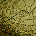Microscopic photo of metal-oxidizing bacteria found in biofilm samples taken from a South African gold mine. Samples were taken as part of the University of Tennessee's (UT) Biogeochemical Educational Experiences - South Africa (BEE-SA)a Research Experiences for Undergraduates (REU) program. BEE-SA participants collected fissure water samples from South African gold mines as part of their research. South African mines, particularly the deep gold mines, have been selected for study because they provide relatively easy access to deep fissure waters and the rocks that host them. Since these mines are some of the deepest excavations in the world, they increase the possibility of uncontaminated studies of earlier evolution.  <I>[To see other images in this group, search for <B>Biogeochemical Educational Experiences in South Africa (Image )</B> and <B></B> using the library search engine.</I><BR>
<BR>
<U><B>More about this Image</B></U><BR>
Supported by the National Science Foundation (NSF) REU program and by UT, BEE-SA brings together U.S. and South African students and faculty mentors in South Africa to examine microbial life forms that exist in the deepest mines in the world. The international host institution is the University of Free State (UFS) in Bloemfontein, South Africa.<BR>
<BR>
Students participating in the BEE-SA program work side by side with South African students under the joint supervision of U.S. and South African faculty, conducting interdisciplinary research on biogeochemical processes in South African gold mines. As part of the research program, students present research results during laboratory progress meetings; at a science symposium held at the conclusion of the REU activity; and in written manuscript format as a final report. During the REU tenure, students have the opportunity to explore scientific, educational and technical collaborations as well as career development. Topics of research include the characterization of microbial communities with molecular and biochemical techniques; utilization of geochemical and isotopic parameters to constrain nutrient cycling in groundwater; investigating extreme enzymes  proteomics; and examining functional genes.<BR>
<BR>
BEE-SA is an outgrowth of NSF-funded research including workshops supported by the NSF-supported Life in Extreme Environments Program (LExEn), managed by Princeton University. The goal of the Princeton LExEn project is to study biochemical approaches for gold extraction at depths beyond the limit of human mining, utilizing mesophilic sulfide oxidizing and Fe (II) oxidizing bacteria prior to cyanidation.  Thumbnail