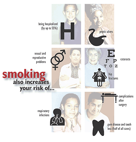 Smoking also increase your risk of...  Please view the text below.