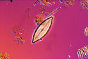 Diatom Species <I>Aneumastus</I> - Thumbnail
