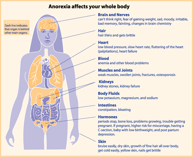 Diagram of health problems caused by anorexia