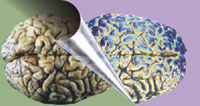 Image of two brains