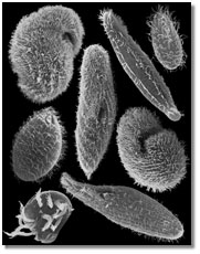 photo showing the ciliates