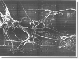 a scanning electron micrograph of frog neurons