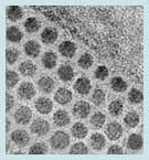 Transmission electron microscope image of nickel nanodots embedded in an aluminum oxide matrix.