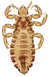 a human head louse