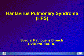 Slide 1 Hantavirus Pulmonary Syndrome Title Slide