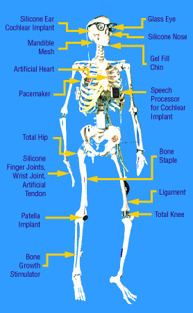 Photo of Yorick with all his medical devices labeled
