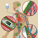 Biofilm Infection Sites - Thumbnail