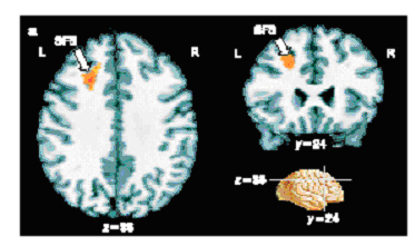 fMRI scan data