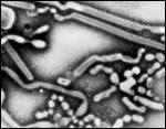 Influenza A Virus Particles
