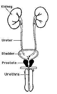Front view diagram of male urinary tract showing normal urine flow from the kidneys through the ureters to the bladder. Urine then passes out of the body through the urethra, which is surrounded by the prostate.